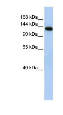 Western Blot: MYBPC2 Antibody [NBP1-70646] - Human Muscle lysate, concentration 0.2-1 ug/ml.
