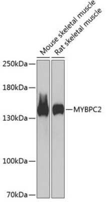 Western Blot: MYBPC2 Antibody [NBP2-93972] - Analysis of extracts of various cell lines, using MYBPC2 at 1:1000 dilution.Secondary antibody: HRP Goat Anti-Rabbit IgG (H+L) at 1:10000 dilution.Lysates/proteins: 25ug per lane.Blocking buffer: 3% nonfat dry milk in TBST.Detection: ECL Basic Kit .Exposure time: 90s.