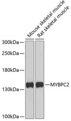 Western Blot: MYBPC2 Antibody [NBP2-95222] - Analysis of extracts of various cell lines, using MYBPC2 at 1:1000 dilution.Secondary antibody: HRP Goat Anti-Rabbit IgG (H+L) at 1:10000 dilution.Lysates/proteins: 25ug per lane.Blocking buffer: 3% nonfat dry milk in TBST.Detection: ECL Basic Kit .Exposure time: 90s.