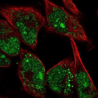 Immunocytochemistry/Immunofluorescence: MYBPH Antibody [NBP2-57149] - Staining of human cell line RH-30 shows localization to nucleus, nucleoli & mitochondria.