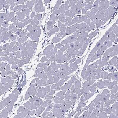 Immunohistochemistry-Paraffin: MYBPH Antibody [NBP2-57149] - Staining of human heart muscle shows low expression as expected.