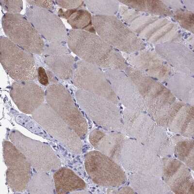 Immunohistochemistry-Paraffin: MYBPH Antibody [NBP2-57149] - Staining of human skeletal muscle shows high expression.