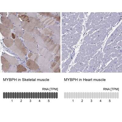 <b>Orthogonal Strategies Validation. </b>Immunohistochemistry-Paraffin: MYBPH Antibody [NBP2-57149] - Staining in human skeletal muscle and heart muscle tissues using anti-MYBPH antibody. Corresponding MYBPH RNA-seq data are presented for the same tissues.