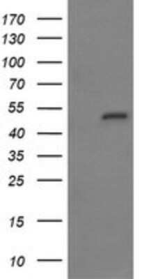 Western Blot: MYBPH Antibody (OTI3G1) - Azide and BSA Free [NBP2-72839] - Analysis of HEK293T cells were transfected with the pCMV6-ENTRY control (Left lane) or pCMV6-ENTRY MYBPH.