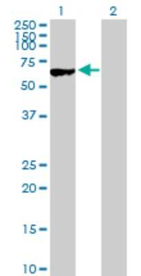 Western Blot: MYBPH Antibody [H00004608-D01P] - Analysis of MYBPH expression in transfected 293T cell line by MYBPH polyclonal antibody.Lane 1: MYBPH transfected lysate(52.00 KDa).Lane 2: Non-transfected lysate.