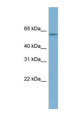 Western Blot: MYBPH Antibody [NBP1-59131] - Titration: 0.2-1 ug/ml, Positive Control: Hela cell lysate.