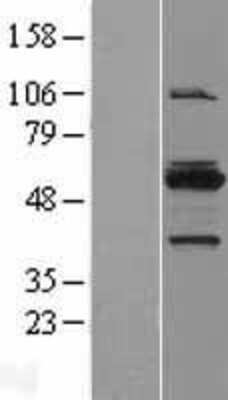 Western Blot: MYBPH Overexpression Lysate (Adult Normal) [NBL1-13413] Left-Empty vector transfected control cell lysate (HEK293 cell lysate); Right -Over-expression Lysate for MYBPH.