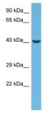 Western Blot: MYBPHL Antibody [NBP3-10161] - Western blot analysis of MYBPHL in Mouse Heart lysates. Antibody dilution at 1ug/ml