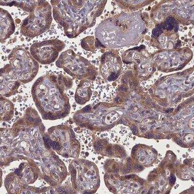 Immunohistochemistry-Paraffin: MYCBP Antibody [NBP1-89101] - Staining of human placenta shows moderate cytoplasmic positivity in trophoblastic cells.