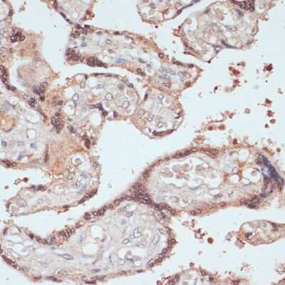 Immunohistochemistry-Paraffin: MYCBP Antibody [NBP2-93175] - Human placenta using MYCBP antibody at dilution of 1:100 (40x lens).