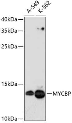 Western Blot MYCBP Antibody - Azide and BSA Free