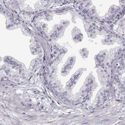 Immunohistochemistry-Paraffin MYCBPAP Antibody - BSA Free