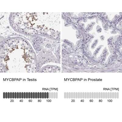 Immunohistochemistry-Paraffin MYCBPAP Antibody - BSA Free