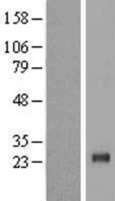 Western Blot MYCL1/L-Myc Overexpression Lysate