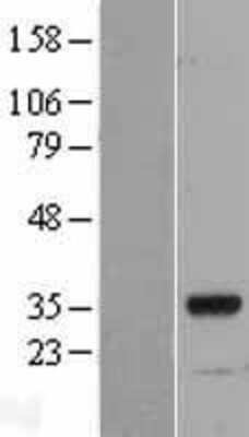 Western Blot: MYF6 Overexpression Lysate (Adult Normal) [NBL1-13421] Left-Empty vector transfected control cell lysate (HEK293 cell lysate); Right -Over-expression Lysate for MYF6.