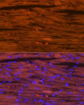 Immunohistochemistry: MYH6/7 Antibody (6V0G1) [NBP3-16520] - Immunofluorescence analysis of rat heart using MYH6/7 Rabbit mAb (NBP3-16520) at dilution of 1:100 (40x lens). Blue: DAPI for nuclear staining.