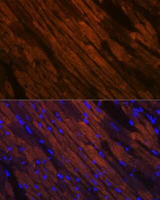 Immunohistochemistry: MYH6/7 Antibody (6V0G1) [NBP3-16520] - Immunofluorescence analysis of mouse heart using MYH6/7 Rabbit mAb (NBP3-16520) at dilution of 1:100 (40x lens). Blue: DAPI for nuclear staining.