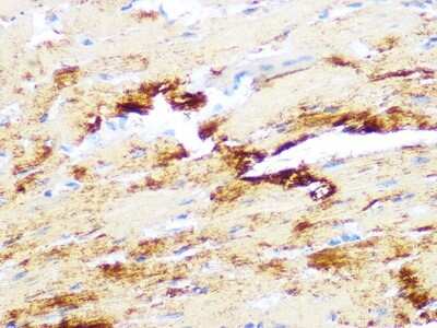 Immunohistochemistry-Paraffin: MYH6/7 Antibody (6V0G1) [NBP3-16520] - Immunohistochemistry of paraffin-embedded mouse heart using MYH6/7 Rabbit mAb (NBP3-16520) at dilution of 1:100 (40x lens).Perform microwave antigen retrieval with 10 mM PBS buffer pH 7.2 before commencing with IHC staining protocol.