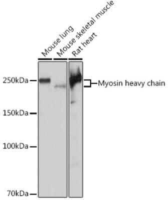 Western Blot: MYH6/7 Antibody (6V0G1) [NBP3-16520] - Western blot analysis of extracts of various cell lines, using MYH6/7 Rabbit mAb (NBP3-16520) at 1:5000 dilution. Secondary antibody: HRP Goat Anti-Rabbit IgG (H+L) at 1:10000 dilution. Lysates/proteins: 25ug per lane. Blocking buffer: 3% nonfat dry milk in TBST. Detection: ECL Basic Kit. Exposure time: 1s.