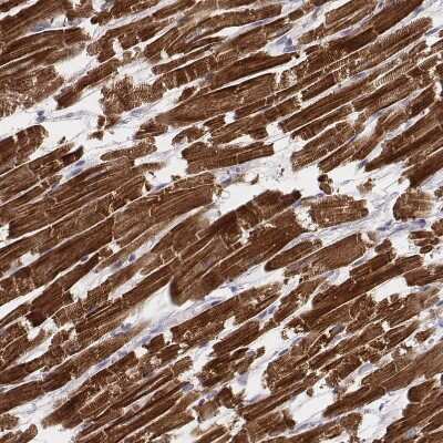 Immunohistochemistry-Paraffin: MYH6 Antibody (CL2148) [NBP2-36744] - Staining of human heart muscle shows very strong cytoplasmic positivity in cardiomyocytes.