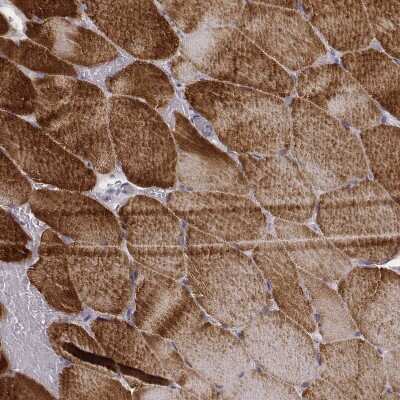 Immunohistochemistry-Paraffin: MYH6 Antibody (CL2148) [NBP2-36744] - Staining of human skeletal muscle shows strong cytoplasmic positivity in striated muscle fibers.