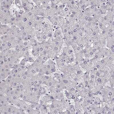 Immunohistochemistry-Paraffin: MYH6 Antibody (CL2148) [NBP2-36744] - Staining of human liver shows no positivity in hepatocytes as expected.