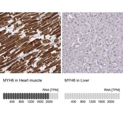 Immunohistochemistry-Paraffin: MYH6 Antibody (CL2148) [NBP2-36744] - Staining in human heart muscle and liver tissues. Corresponding MYH6 RNA-seq data are presented for the same tissues.