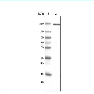 <b>Orthogonal Strategies Validation. </b>Western Blot: MYH6 Antibody (CL2148) [NBP2-36744] - Analysis of human skeletal muscle tissue lysate.