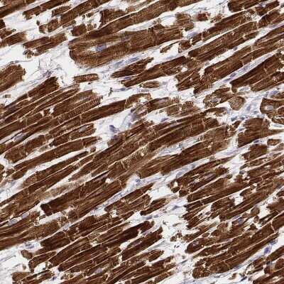 Immunohistochemistry-Paraffin: MYH6 Antibody (CL2155) [NBP2-36745] - Staining of human heart muscle shows very strong cytoplasmic positivity in cardiomyocytes.