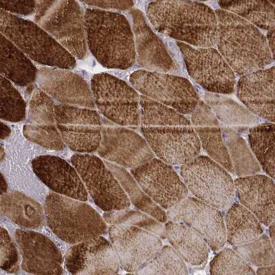 Immunohistochemistry-Paraffin: MYH6 Antibody (CL2155) [NBP2-36745] - Staining of human skeletal muscle shows strong cytoplasmic positivity in striated muscle fibers.