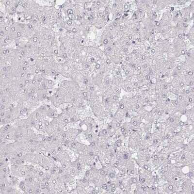 Immunohistochemistry-Paraffin: MYH6 Antibody (CL2155) [NBP2-36745] - Staining of human liver shows no positivity in hepatocytes as expected.