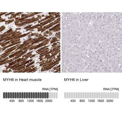 Immunohistochemistry-Paraffin: MYH6 Antibody (CL2155) [NBP2-36745] - Staining in human heart muscle and liver tissues. Corresponding MYH6 RNA-seq data are presented for the same tissues.