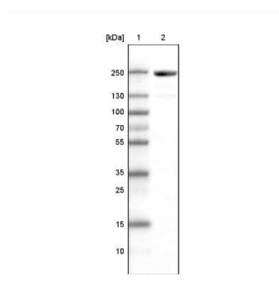 <b>Orthogonal Strategies Validation. </b>Western Blot: MYH6 Antibody (CL2155) [NBP2-36745] - Analysis of human skeletal muscle tissue lysate.