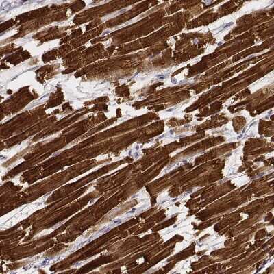 Immunohistochemistry-Paraffin: MYH6 Antibody (CL2162) [NBP2-36746] - Staining of human heart muscle shows very strong cytoplasmic positivity in cardiomyocytes.