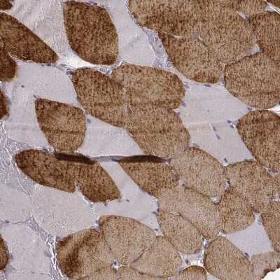 Immunohistochemistry-Paraffin: MYH6 Antibody (CL2162) [NBP2-36746] - Staining of human skeletal muscle shows strong cytoplasmic positivity in striated muscle fibers.