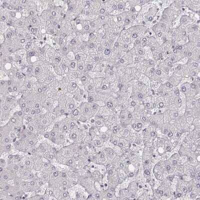 Immunohistochemistry-Paraffin: MYH6 Antibody (CL2162) [NBP2-36746] - Staining of human liver shows no positivity in hepatocytes as expected.