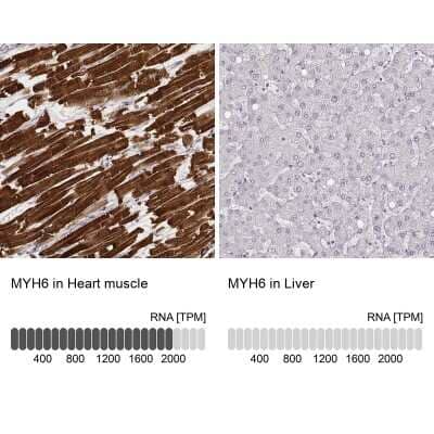 Immunohistochemistry-Paraffin: MYH6 Antibody (CL2162) [NBP2-36746] - Staining in human heart muscle and liver tissues. Corresponding MYH6 RNA-seq data are presented for the same tissues.