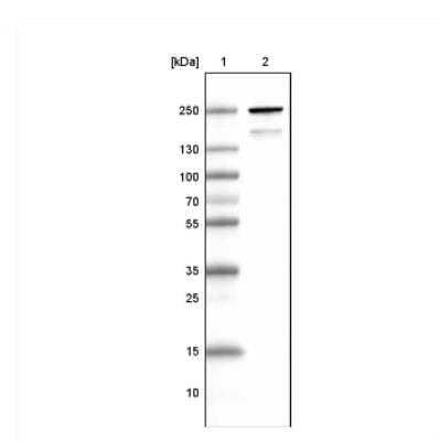 <b>Orthogonal Strategies Validation. </b>Western Blot: MYH6 Antibody (CL2162) [NBP2-36746] - Lane 1: Marker  [kDa] Lane 2: Human skeletal muscle tissue lysate