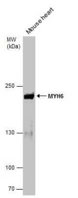 Western Blot: MYH6 Antibody (GT565) [NBP3-13525] - Mouse tissue extract (50 ug) was separated by 5% SDS-PAGE, and the membrane was blotted with MYH6 antibody [GT565] (NBP3-13525) diluted at 1:5000.