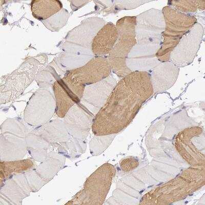 Immunohistochemistry-Paraffin: MYH6 Antibody [NBP1-88120] - Staining of human skeletal muscle shows moderate cytoplasmic positivity in a subset of myocytes.