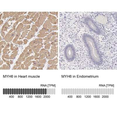 <b>Orthogonal Strategies Validation. </b>Immunohistochemistry-Paraffin: MYH6 Antibody [NBP1-88120] - Analysis in human heart muscle and endometrium tissues. Corresponding MYH6 RNA-seq data are presented for the same tissues.