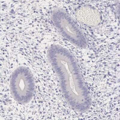 Immunohistochemistry-Paraffin: MYH6 Antibody [NBP1-88120] - Staining of human endometrium shows no positivity in glandular cells as expected.