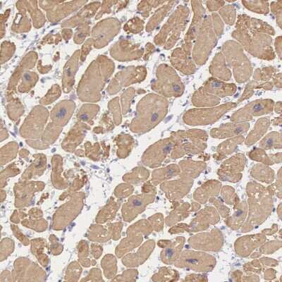 Immunohistochemistry-Paraffin: MYH6 Antibody [NBP1-88120] - Staining of human heart muscle shows moderate cytoplasmic positivity in cardiomyocytes.