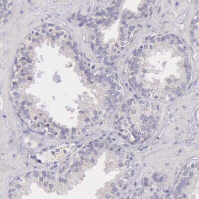 Immunohistochemistry-Paraffin: MYH6 Antibody [NBP1-88120] - Staining of human prostate shows no positivity in smooth muscle cells as expected.