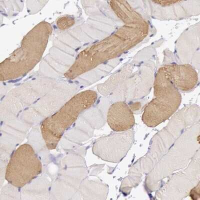 Immunohistochemistry-Paraffin: MYH6 Antibody [NBP1-88120] - Staining of human skeletal muscle shows moderate cytoplasmic positivity in a subset of myocytes.