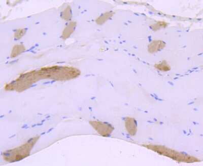 Immunohistochemistry-Paraffin: MYH6 Antibody (JF097-7) [NBP2-66965] - Analysis of paraffin-embedded mouse smooth muscle tissue using anti-Myosin heavy chain antibody. Counter stained with hematoxylin.