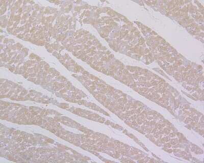 Immunohistochemistry-Paraffin: MYH6 Antibody (JF097-7) [NBP2-66965] - Immunohistochemical analysis of paraffin-embedded rat heart tissue using anti-MYH6 antibody. The section was pre-treated using heat mediated antigen retrieval with Tris-EDTA buffer (pH 8.0-8.4) for 20 minutes. The tissues were blocked in 5% BSA for 30 minutes at room temperature, washed with ddH2O and PBS, and then probed with the primary antibody (1/400) for 30 minutes at room temperature. The detection was performed using an HRP conjugated compact polymer system. DAB was used as the chromogen. Tissues were counterstained with hematoxylin and mounted with DPX.