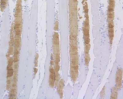 Immunohistochemistry-Paraffin: MYH6 Antibody (JF097-7) [NBP2-66965] - Immunohistochemical analysis of paraffin-embedded rat skeletal muscle tissue using anti-MYH6 antibody. The section was pre-treated using heat mediated antigen retrieval with Tris-EDTA buffer (pH 8.0-8.4) for 20 minutes. The tissues were blocked in 5% BSA for 30 minutes at room temperature, washed with ddH2O and PBS, and then probed with the primary antibody (1/400) for 30 minutes at room temperature. The detection was performed using an HRP conjugated compact polymer system. DAB was used as the chromogen. Tissues were counterstained with hematoxylin and mounted with DPX.
