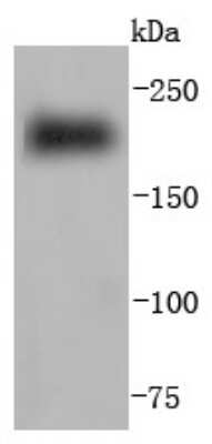 Western Blot: MYH6 Antibody (JF097-7) [NBP2-66965] - Analysis of Myosin heavy chain on human skeletal muscle lysates using anti-Myosin heavy chain antibody at 1/1,000 dilution.
