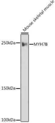 Western Blot: MYH7B Antibody (7W8J3) [NBP3-16495] - Western blot analysis of extracts of Mouse skeletal muscle, using MYH7B antibody (NBP3-16495) at 1:1000 dilution. Secondary antibody: HRP Goat Anti-Rabbit IgG (H+L) at 1:10000 dilution. Lysates/proteins: 25ug per lane. Blocking buffer: 3% nonfat dry milk in TBST. Detection: ECL Basic Kit. Exposure time: 1s.